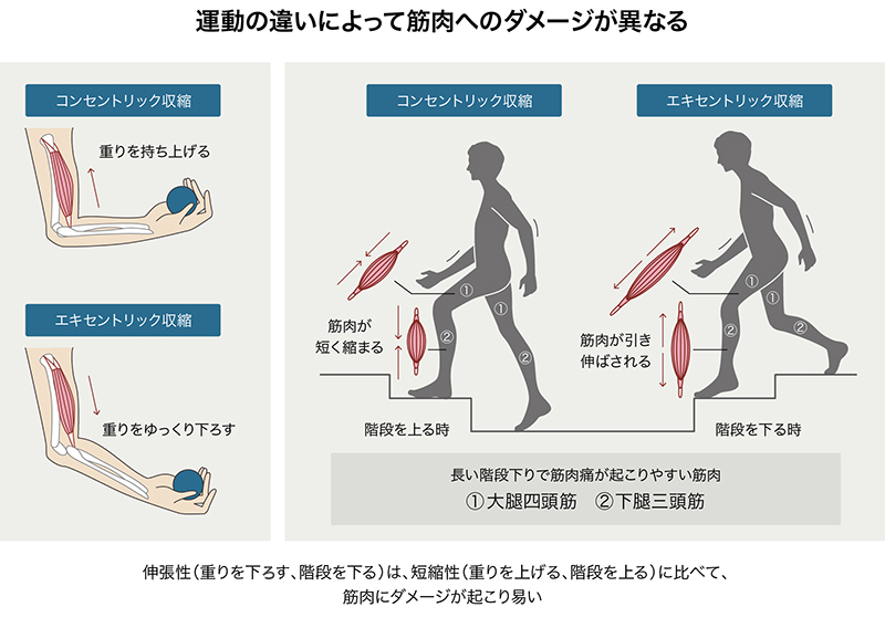 運動の違いによって筋肉へのダメージが異なる