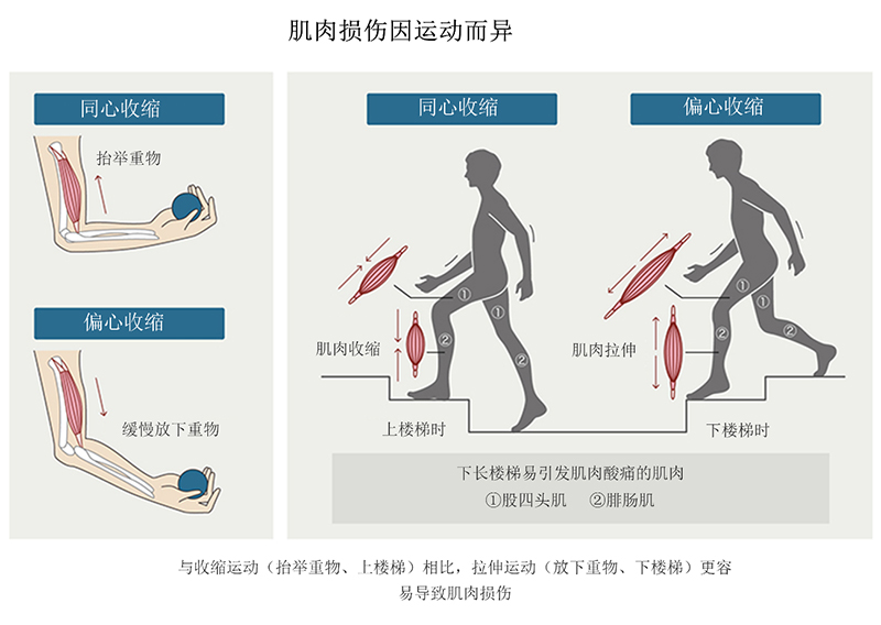 不同的运动会对肌肉造成不同的损伤。