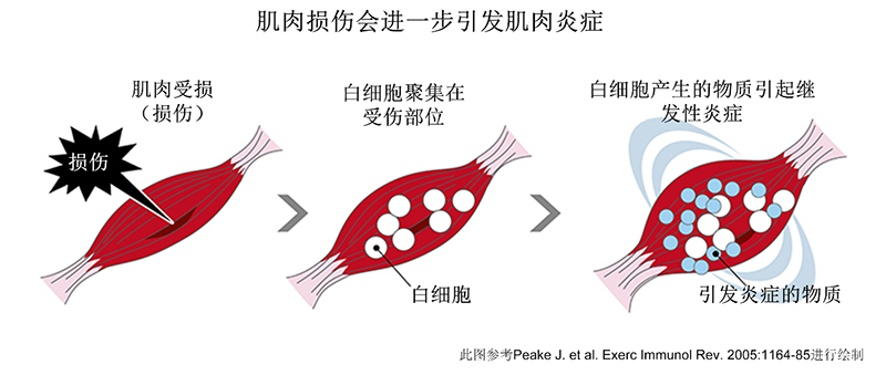 肌肉损伤会导致进一步的肌肉炎症。