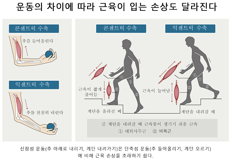 운동의 차이에 따라 근육에 대한 손상이 달라집니다.