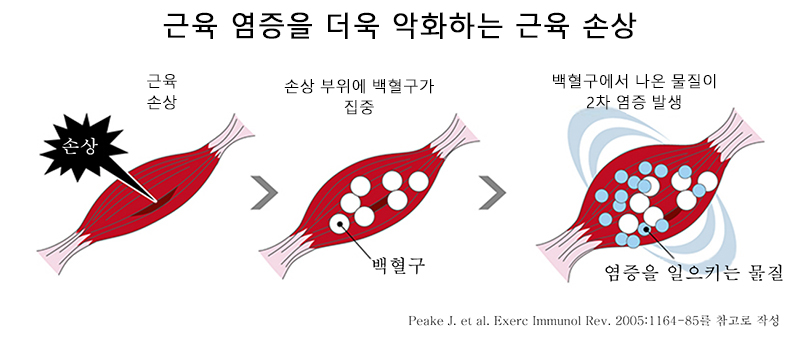 근육 손상은 근육의 염증을 더 일으킨다
