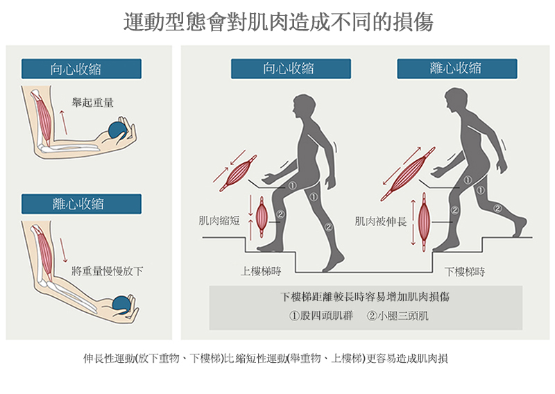 不同的運動會對肌肉造成不同的傷害。