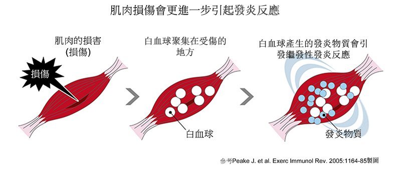 肌肉損傷會導致進一步的肌肉發炎。